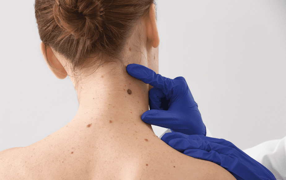 médecin qui analyse les grains de beauté sur la nuque d'une femme
