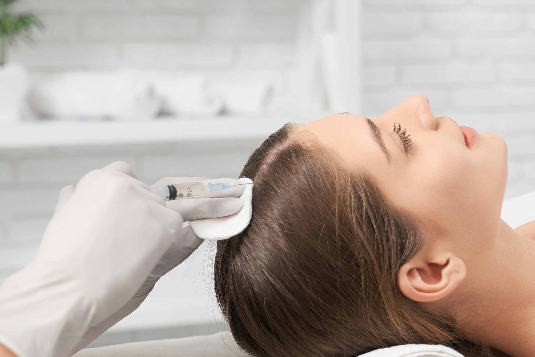 injections d'implants capillaire sur une femme