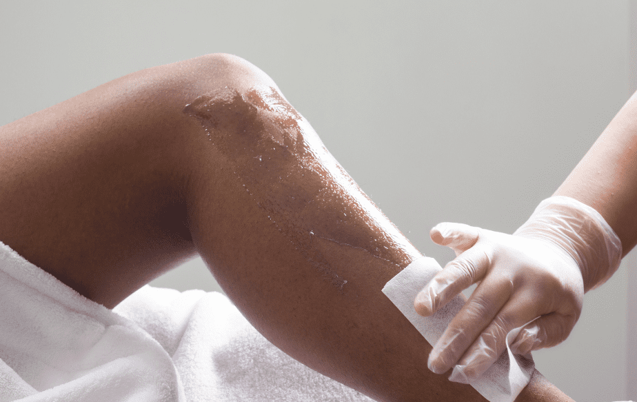 une personne qui souffre d'hirsutisme sur les jambes