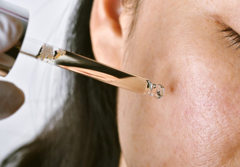 Une personne qui se met de l'huile de tea tree pour calmer son acné