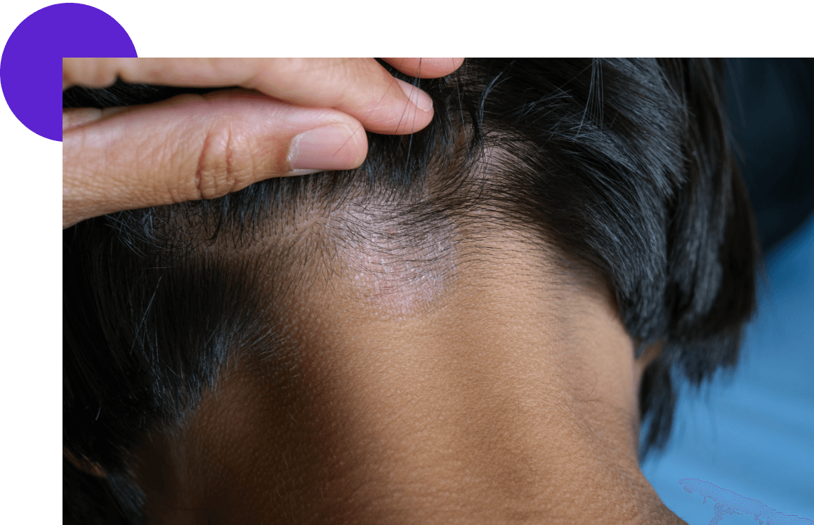 L’attribut alt de cette image est vide, son nom de fichier est Teigne-chez-lhomme-1.png.