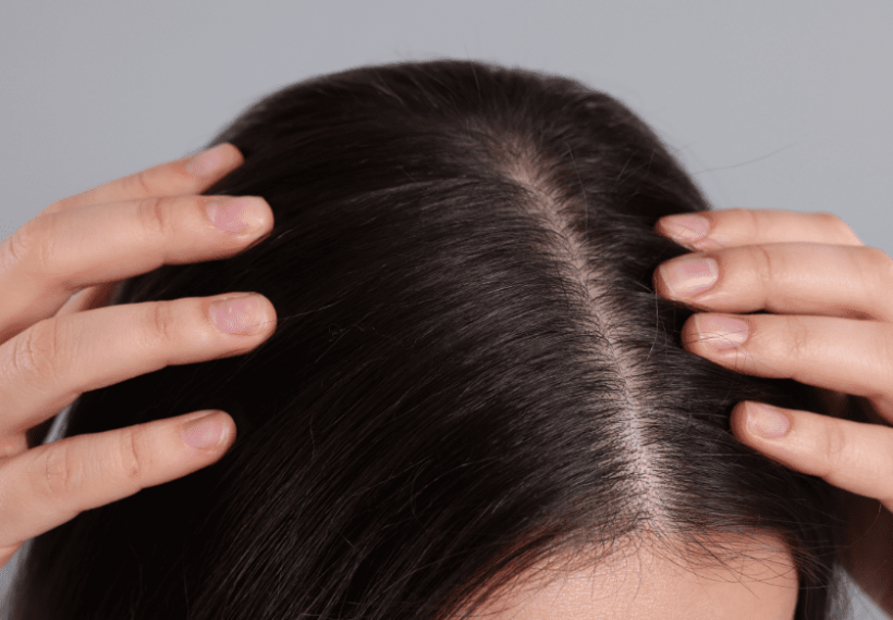 Une femme qui masse son cuir chevelu pour favoriser la repousse de ses cheveux