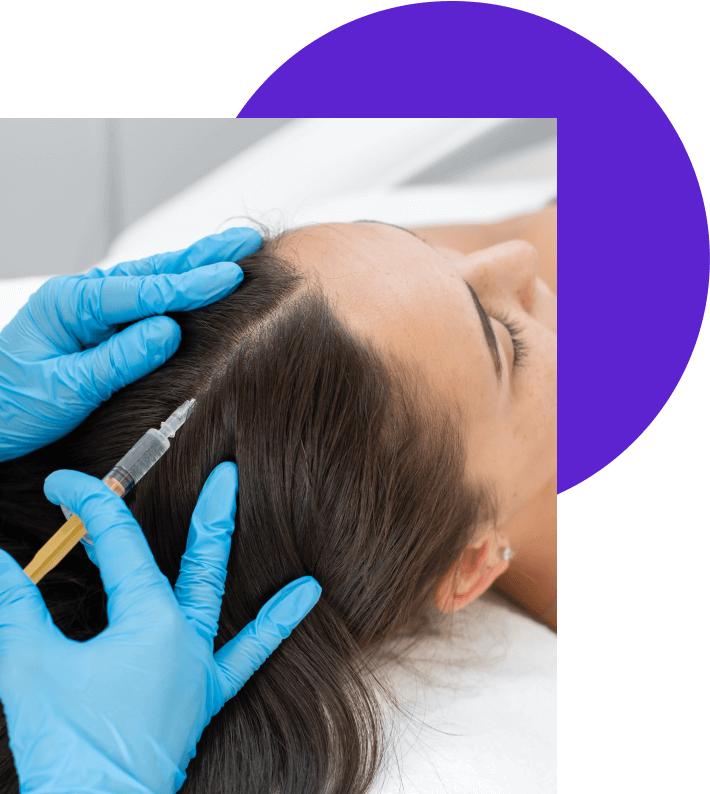 Mésothérapie cheveux