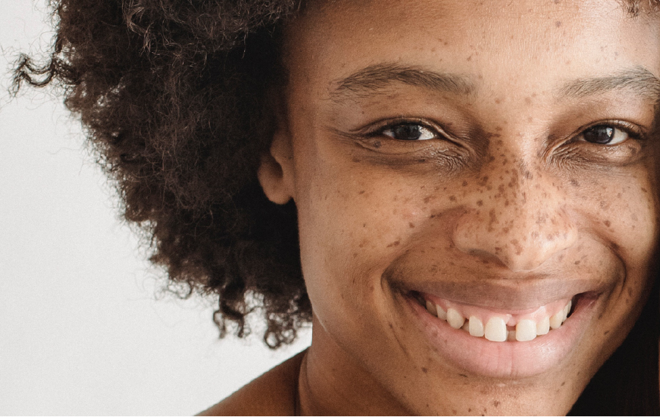 Fille avec des taches brunes sur le visage