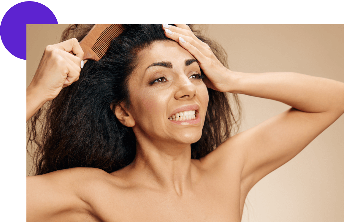 pelade chez la femme