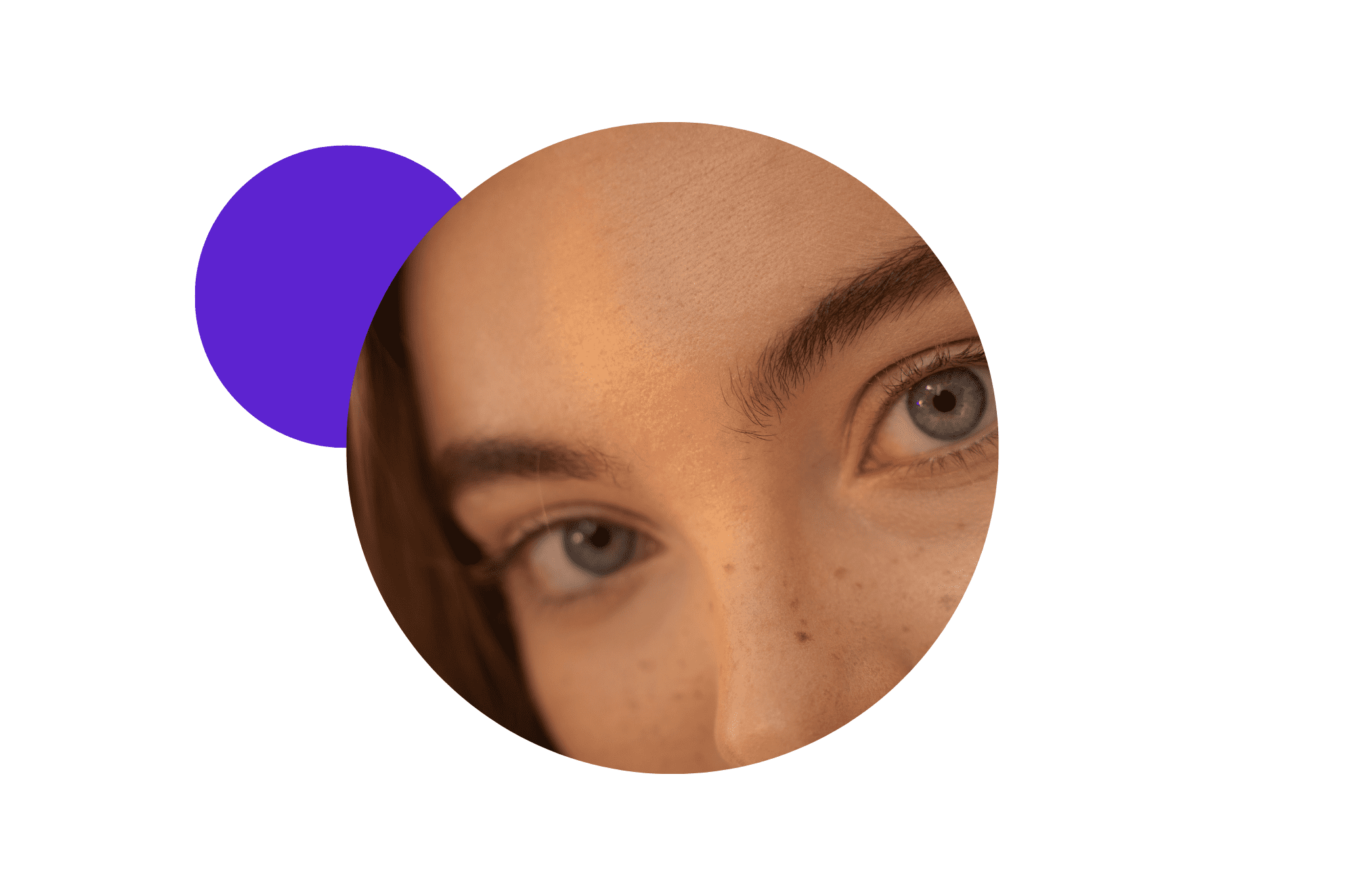 résultats naturels d'un soin au laser