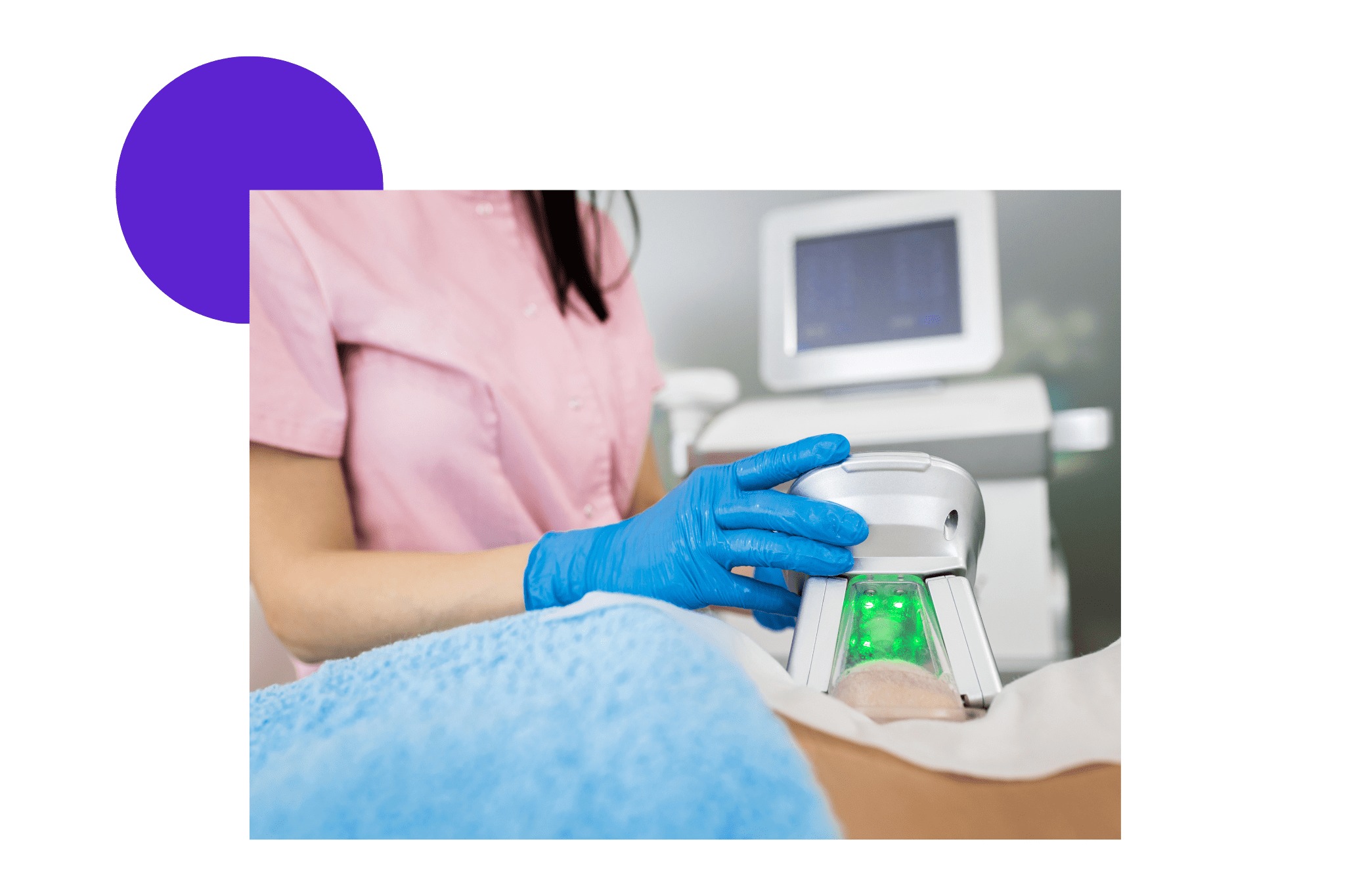 séance de cryolipolyse sur les hanches