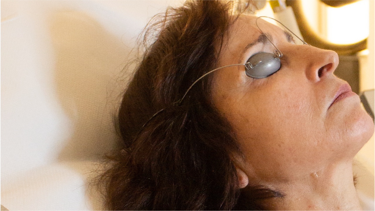 Séance laser endolift