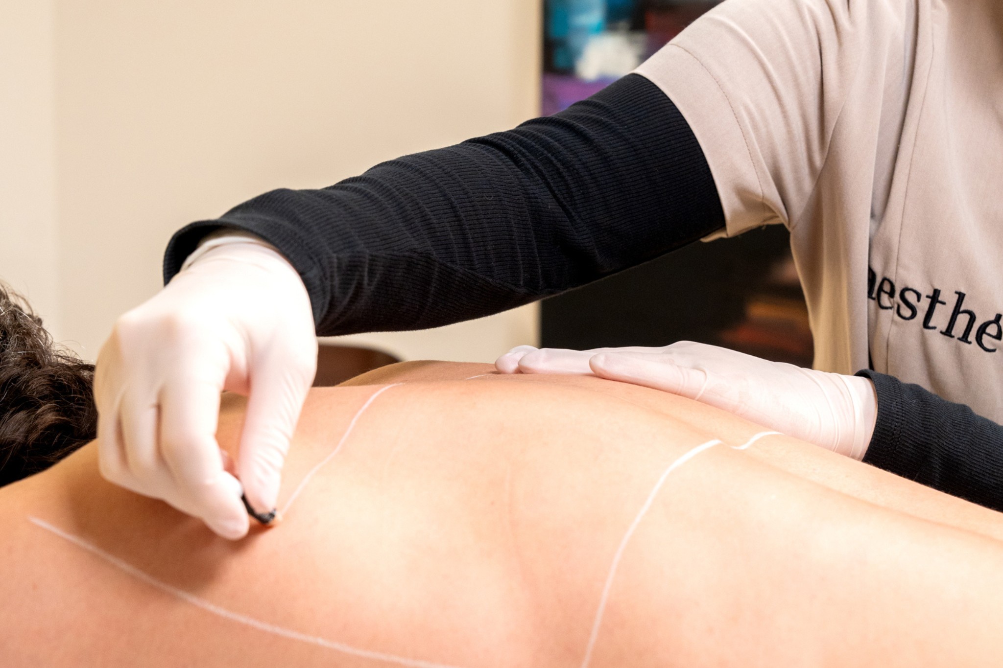 Préparation de la zone à traiter avant une séance d'épilation laser du dos