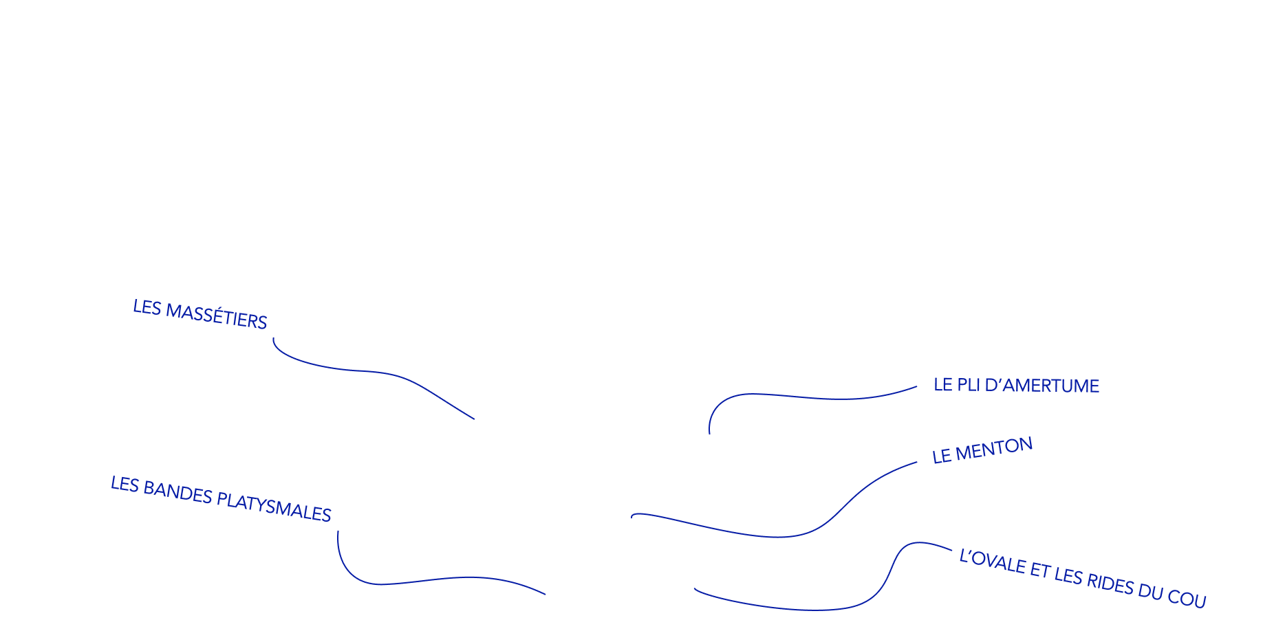 tracés des zones de l'ovale du visage que l'on peut traiter avec le botox