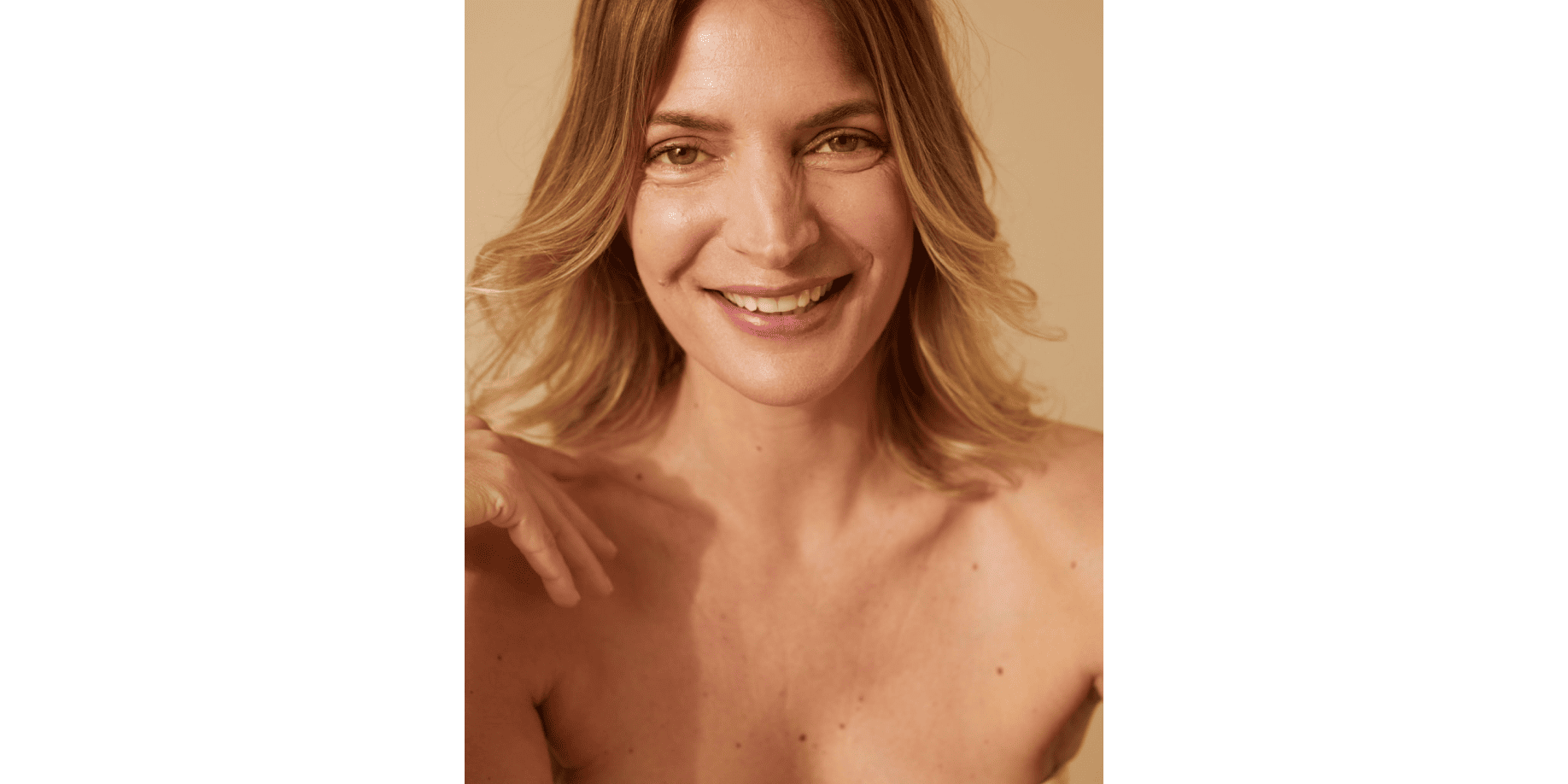 Une femme avec des poches sous les yeux à cause d'une hernie graisseuse