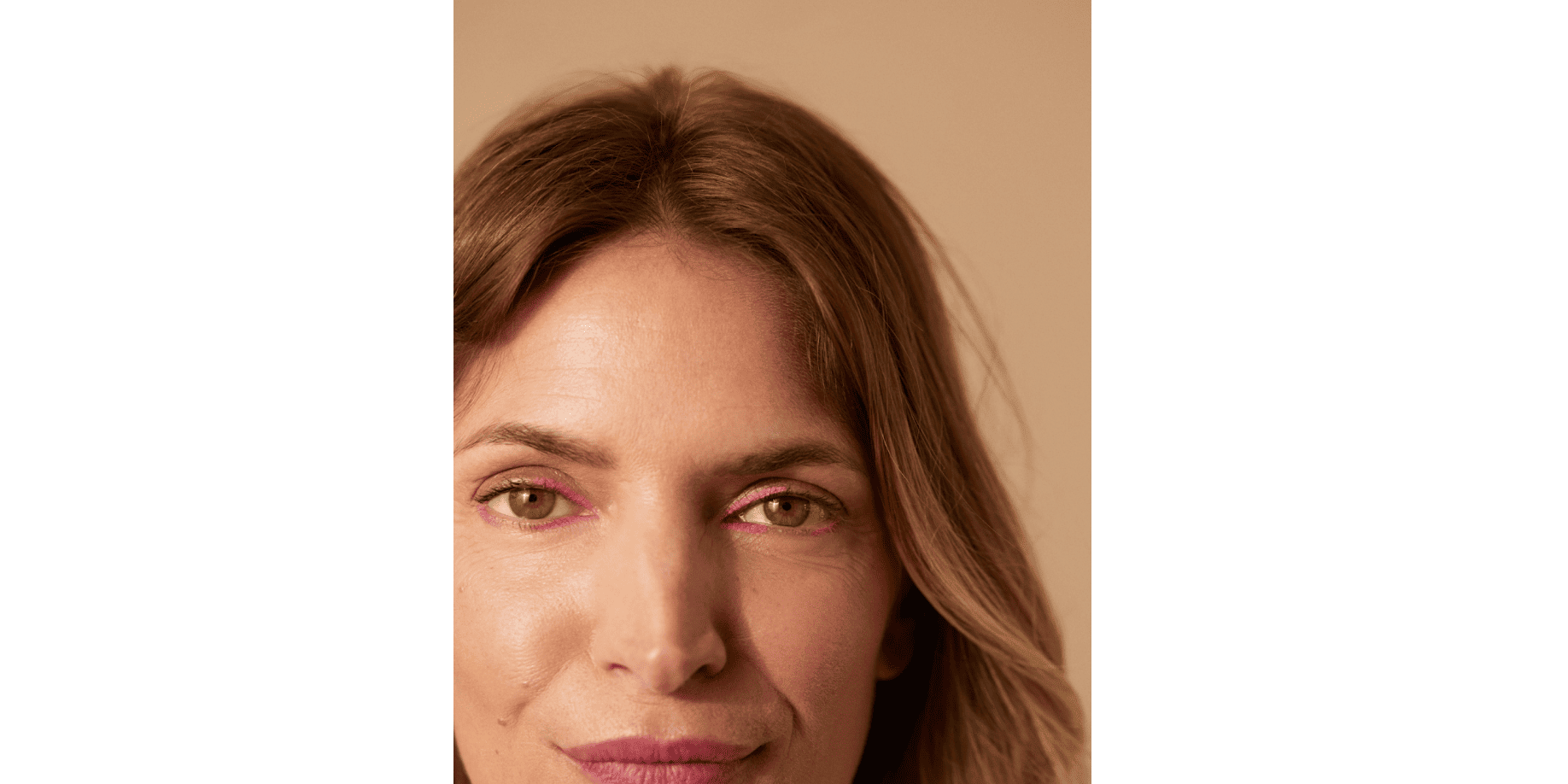 Une femme âgée qui a une vallée des larmes causée par la fonte graisseuse