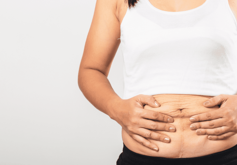 ventre d'une femme après son accouchement